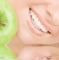 BLANQUEAMIENTO DENTAL